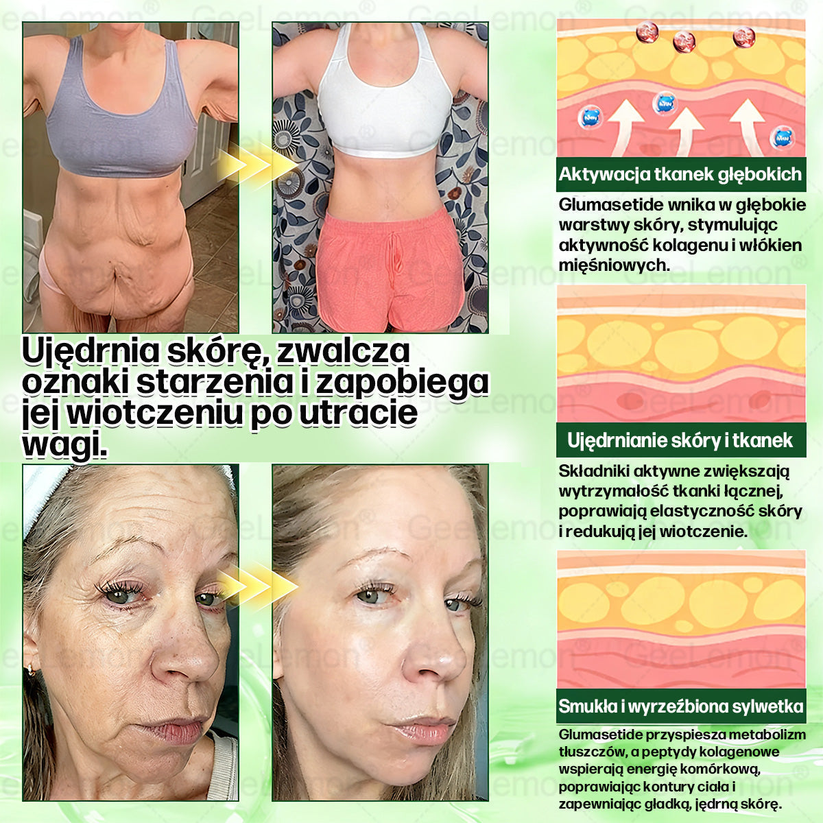 🌱Oficjalny Sklep | 👩‍⚕️🎁 𝐆𝐞𝑒𝐿𝑒𝐦𝐨𝐧® 𝐆𝐥𝐮𝐦ase𝐭𝐢𝐝𝐞 𝟖 𝐰 𝟏 Smukły i Zdrowy Nano Plaster z Mikronakłuciami 🇵🇱(Tylko raz dziennie, widoczne zmiany już w 7 dni)✅ Na otyłość, 🅛🅞🅞🅢🅔 🅢🅚🅘🅝 wiotką skórę, cukrzycę, bezdech senny, problemy ze stawami i wiele więcej