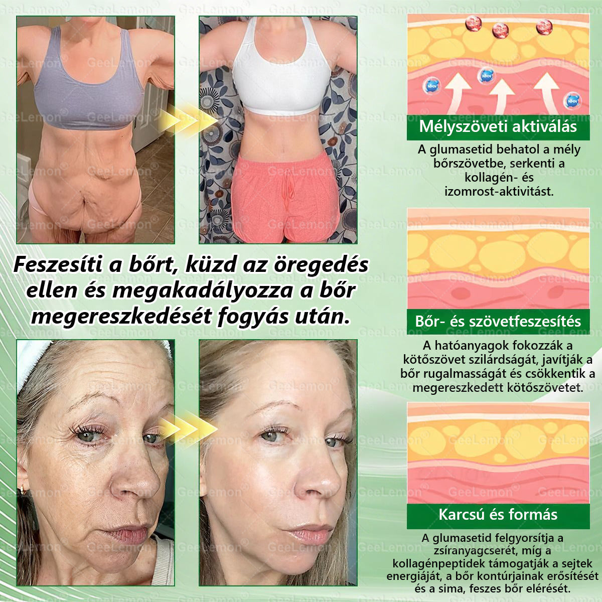 ⚡ Vásárolj 5-öt, kapj 5-öt ajándékba! | Magyar szakértők által ajánlott · 👩‍⚕️ Hivatalos márkabolt | 🎁 GeeLemon® Glumasetide 8 az 1-ben Karcsú és Egészséges Nano Mikrotűs Tapasz 🇭🇺