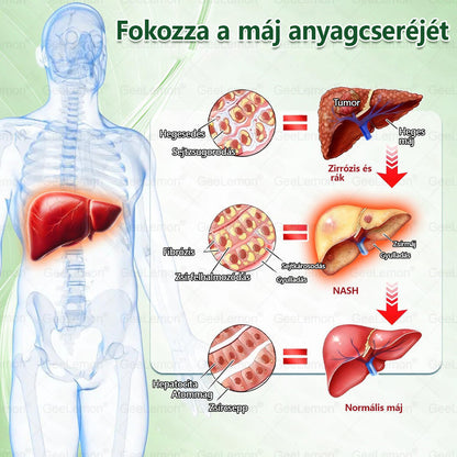 ⚡ Vásárolj 5-öt, kapj 5-öt ajándékba! | Magyar szakértők által ajánlott · 👩‍⚕️ Hivatalos márkabolt | 🎁 GeeLemon® Glumasetide 8 az 1-ben Karcsú és Egészséges Nano Mikrotűs Tapasz 🇭🇺