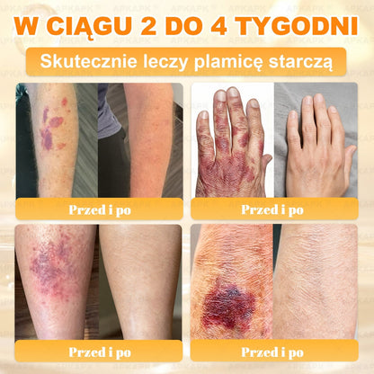Polecane przez USK w Białymstoku · Wyprodukowano w Polsce✨✨ 𝖠𝖯𝖪𝖠𝖯𝖪® krem regenerujący skórę z jadem pszczelim