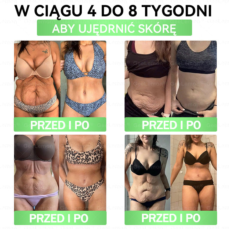 🌱Oficjalny Sklep | 👩‍⚕️🎁 𝐆𝐞𝑒𝐿𝑒𝐦𝐨𝐧® 𝐆𝐥𝐮𝐦ase𝐭𝐢𝐝𝐞 𝟖 𝐰 𝟏 Smukły i Zdrowy Nano Plaster z Mikronakłuciami 🇵🇱(Tylko raz dziennie, widoczne zmiany już w 7 dni)✅ Na otyłość, 🅛🅞🅞🅢🅔 🅢🅚🅘🅝 wiotką skórę, cukrzycę, bezdech senny, problemy ze stawami i wiele więcej