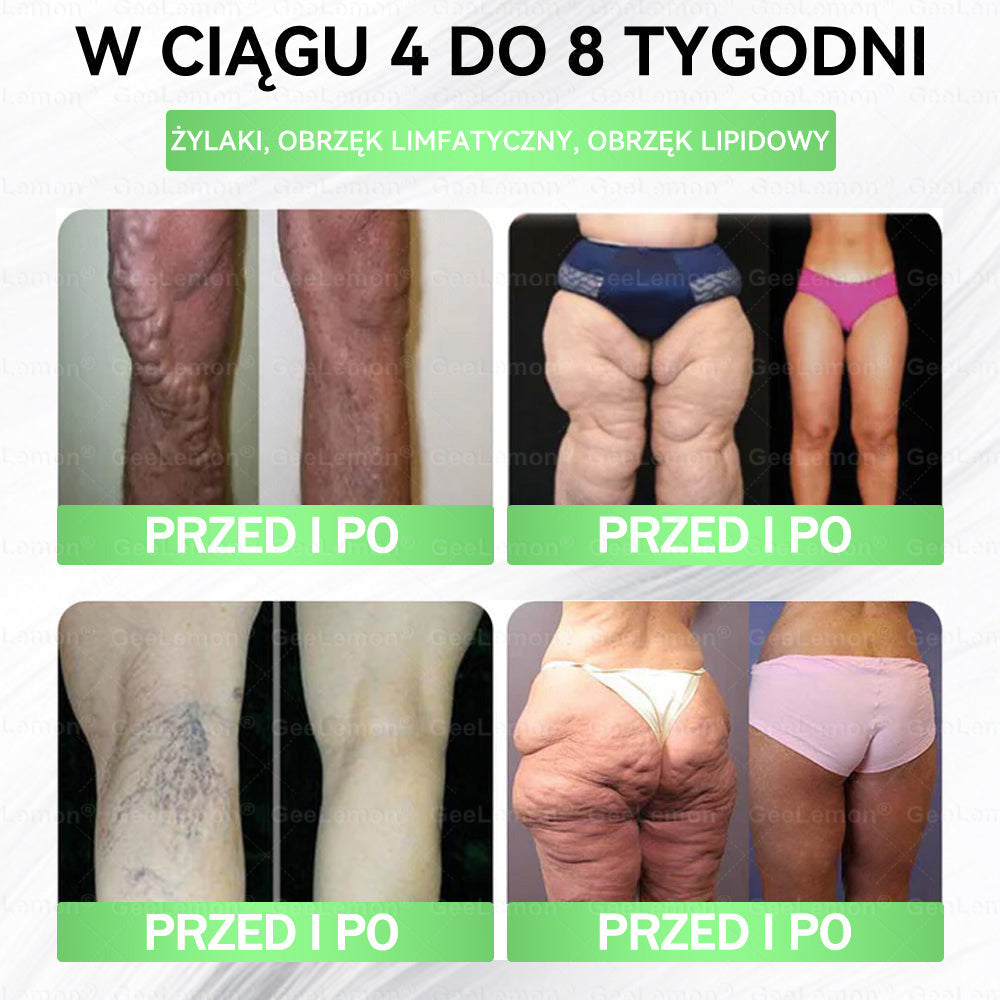 🌱Oficjalny Sklep | 👩‍⚕️🎁 𝐆𝐞𝑒𝐿𝑒𝐦𝐨𝐧® 𝐆𝐥𝐮𝐦ase𝐭𝐢𝐝𝐞 𝟖 𝐰 𝟏 Smukły i Zdrowy Nano Plaster z Mikronakłuciami 🇵🇱(Tylko raz dziennie, widoczne zmiany już w 7 dni)✅ Na otyłość, 🅛🅞🅞🅢🅔 🅢🅚🅘🅝 wiotką skórę, cukrzycę, bezdech senny, problemy ze stawami i wiele więcej