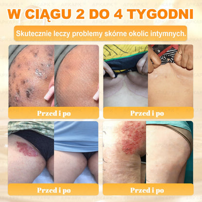 Polecane przez USK w Białymstoku · Wyprodukowano w Polsce✨✨ 𝖠𝖯𝖪𝖠𝖯𝖪® krem regenerujący skórę z jadem pszczelim