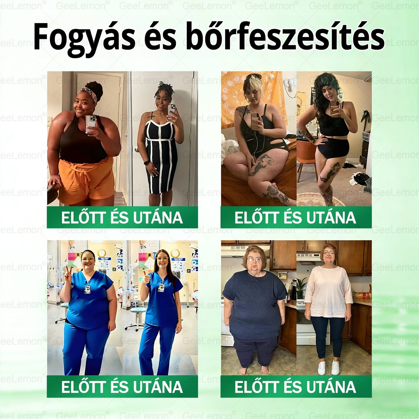 ⚡ Vásárolj 5-öt, kapj 5-öt ajándékba! | Magyar szakértők által ajánlott · 👩‍⚕️ Hivatalos márkabolt | 🎁 GeeLemon® Glumasetide 8 az 1-ben Karcsú és Egészséges Nano Mikrotűs Tapasz 🇭🇺