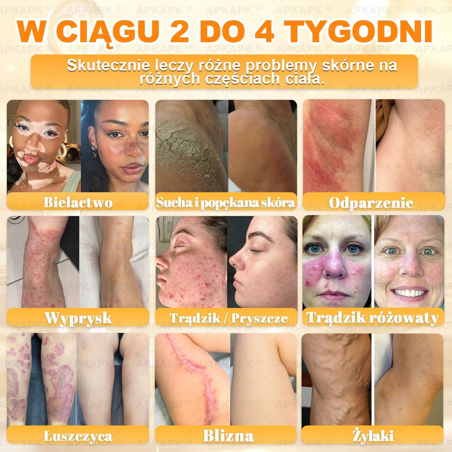 Polecane przez USK w Białymstoku · Wyprodukowano w Polsce✨✨ 𝖠𝖯𝖪𝖠𝖯𝖪® krem regenerujący skórę z jadem pszczelim