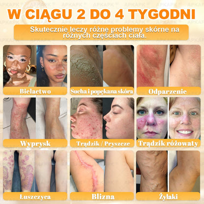 Polecane przez USK w Białymstoku · Wyprodukowano w Polsce✨✨ 𝖠𝖯𝖪𝖠𝖯𝖪® krem regenerujący skórę z jadem pszczelim