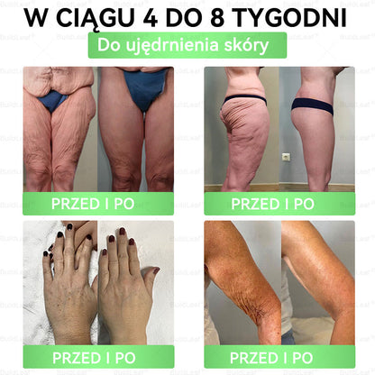 🎅🎄 Merry Christmas | Oficjalny sklep 👩‍⚕️ BuildLeaf® GLP-1 8-w-1 roztwór doustny (raz dziennie, efekty w 7 dni) Wspiera odchudzanie, serce, cukier, sen, jelita, stawy oraz ujędrnia skórę i dodaje energii