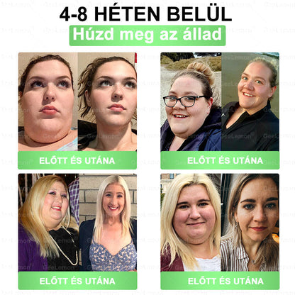 ⚡ Vásárolj 5-öt, kapj 5-öt ajándékba! | Magyar szakértők által ajánlott · 👩‍⚕️ Hivatalos márkabolt | 🎁 GeeLemon® Glumasetide 8 az 1-ben Karcsú és Egészséges Nano Mikrotűs Tapasz 🇭🇺