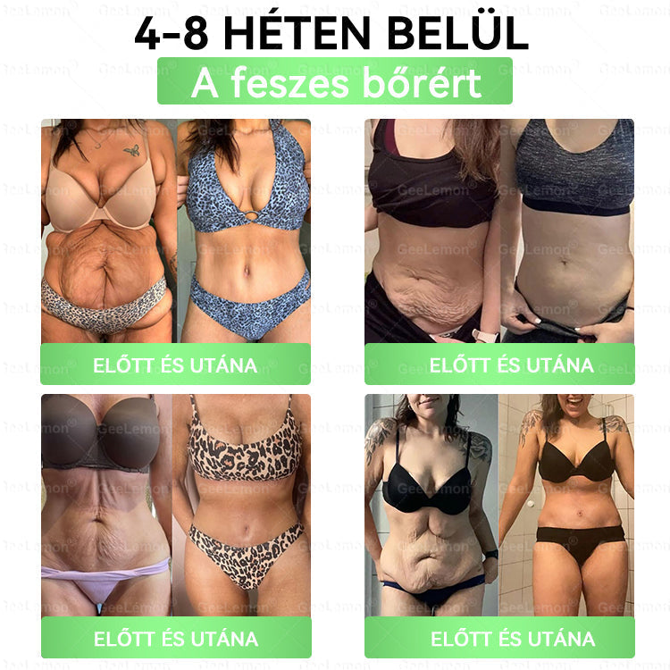 ⚡ Vásárolj 5-öt, kapj 5-öt ajándékba! | Magyar szakértők által ajánlott · 👩‍⚕️ Hivatalos márkabolt | 🎁 GeeLemon® Glumasetide 8 az 1-ben Karcsú és Egészséges Nano Mikrotűs Tapasz 🇭🇺
